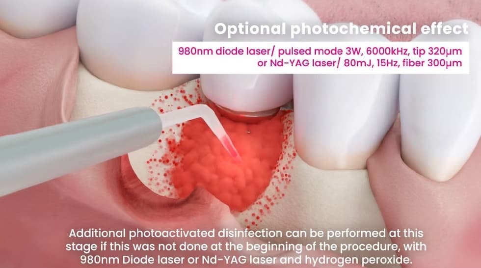 decontamination procedure