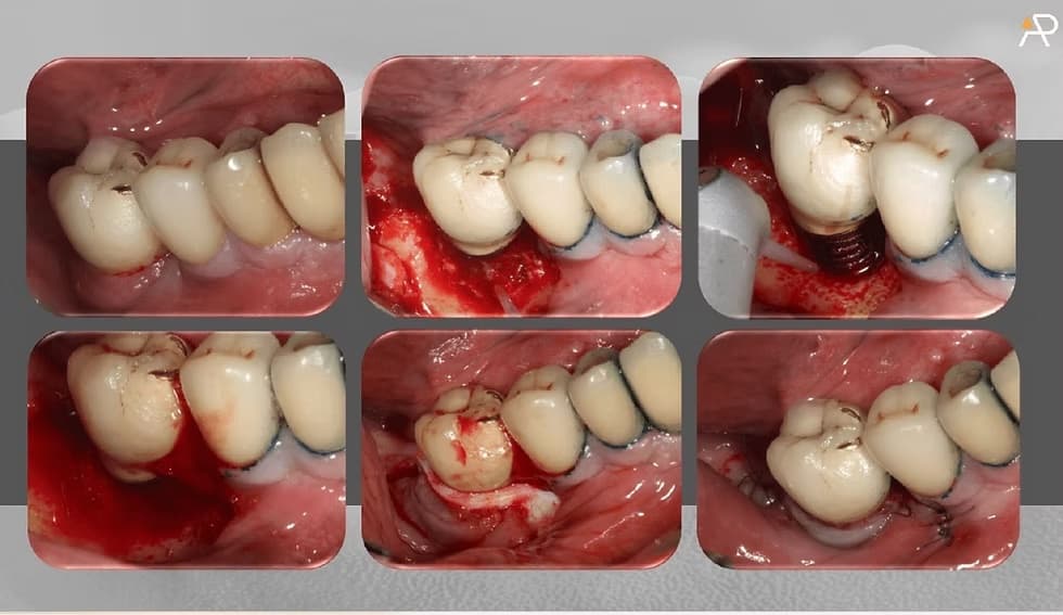 treatment follow-up image
