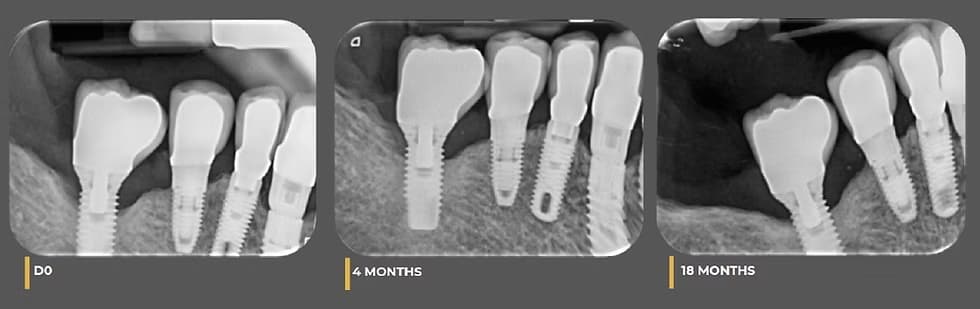 long-term results