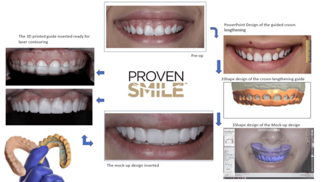 proven smile